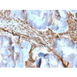 Immunohistochemistry - Anti-Vimentin Antibody [rVIM/6431] (A250304) - Antibodies.com