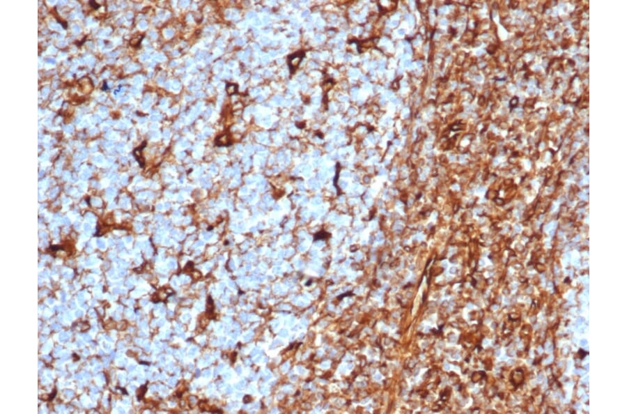 Immunohistochemistry - Anti-Vimentin Antibody [rVIM/6575] (A250306) - Antibodies.com