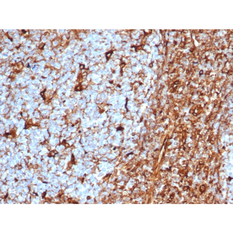 Immunohistochemistry - Anti-Vimentin Antibody [rVIM/6575] (A250306) - Antibodies.com