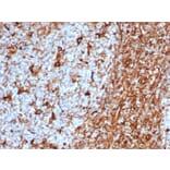 Immunohistochemistry - Anti-Vimentin Antibody [rVIM/6575] (A250306) - Antibodies.com