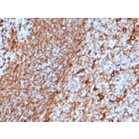 Immunohistochemistry - Anti-Vimentin Antibody [rVIM/6575] (A250305) - Antibodies.com