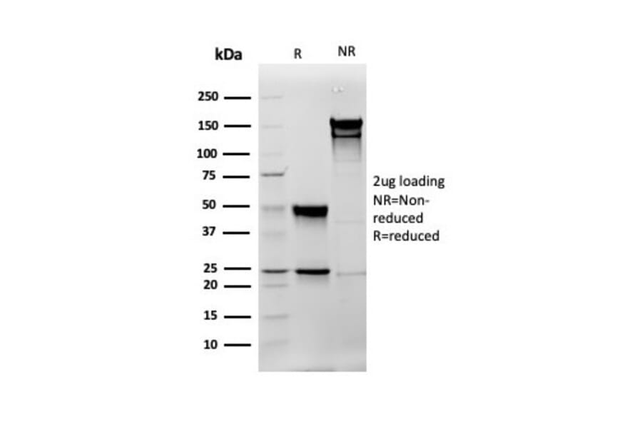 SDS-PAGE - Anti-Vimentin Antibody [rVIM/6575] (A250306) - Antibodies.com