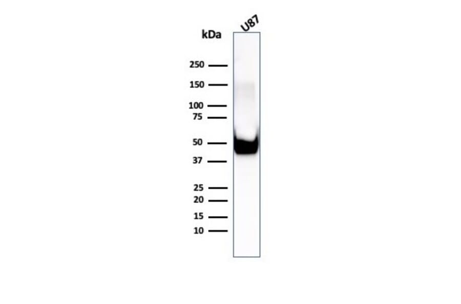 Western Blot - Anti-Vimentin Antibody [rVIM/6575] (A250306) - Antibodies.com