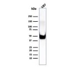 Western Blot - Anti-Vimentin Antibody [rVIM/6575] (A250306) - Antibodies.com