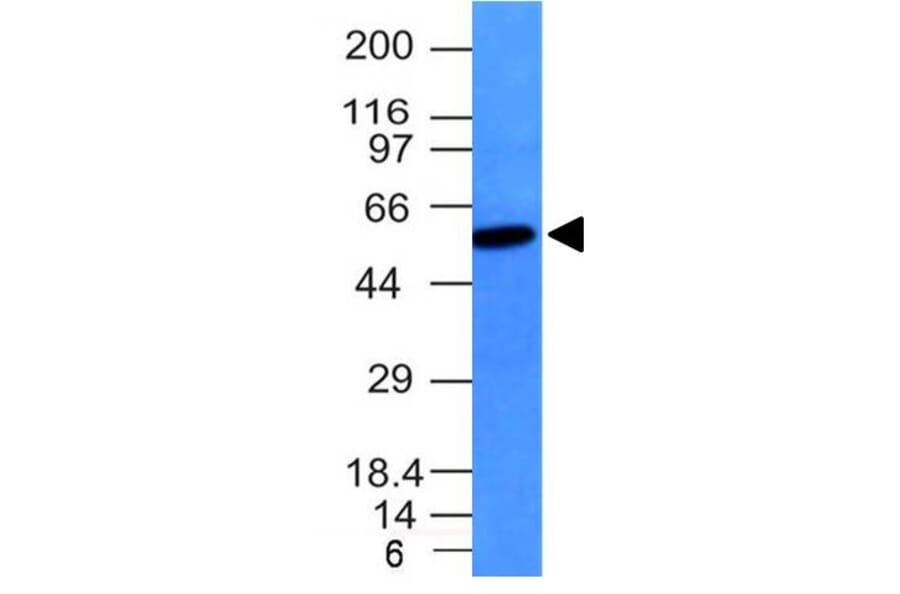 Western Blot - Anti-Vimentin Antibody [VM452] (A250307) - Antibodies.com