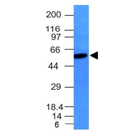Western Blot - Anti-Vimentin Antibody [VM452] (A250307) - Antibodies.com
