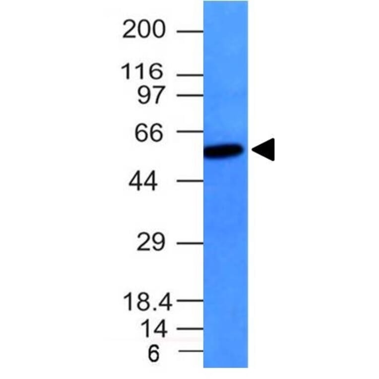 Western Blot - Anti-Vimentin Antibody [VM452] (A250307) - Antibodies.com