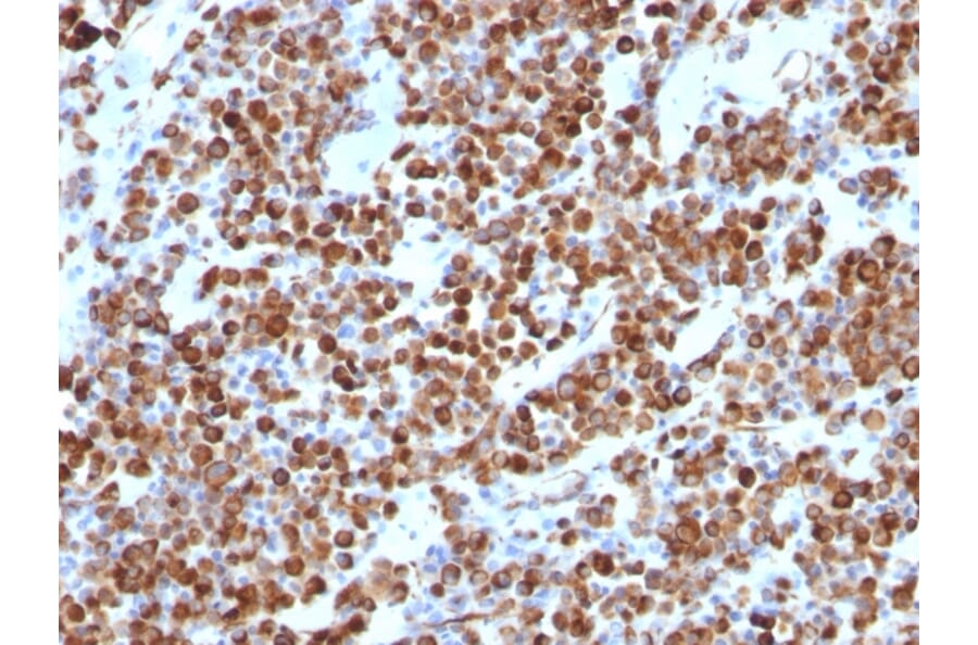 Immunohistochemistry - Anti-Vimentin Antibody [VM452] (A250307) - Antibodies.com