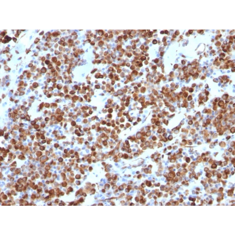 Immunohistochemistry - Anti-Vimentin Antibody [VM452] (A250307) - Antibodies.com