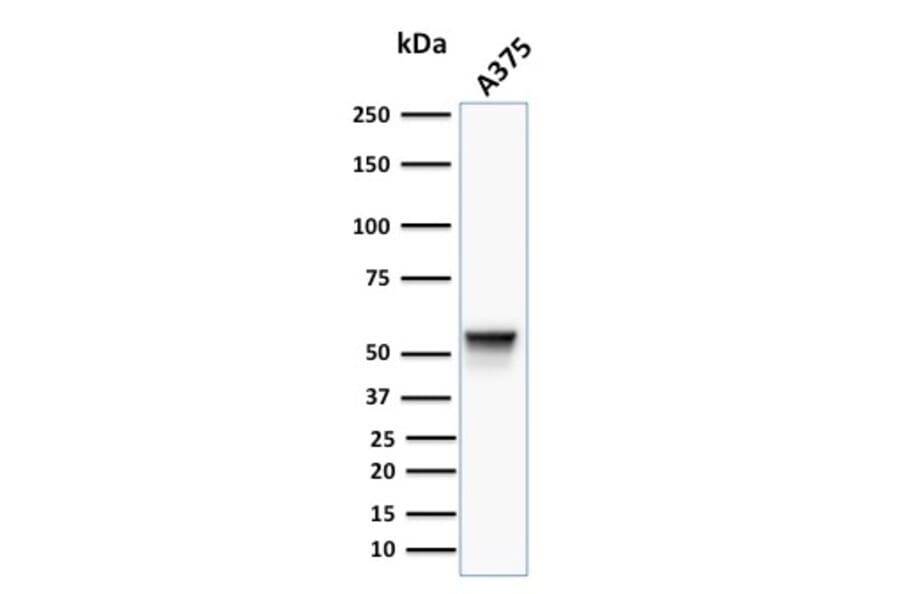 Western Blot - Anti-Vimentin Antibody [VM452] (A250307) - Antibodies.com