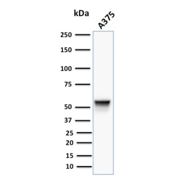 Western Blot - Anti-Vimentin Antibody [VM452] (A250307) - Antibodies.com