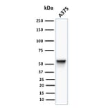 Western Blot - Anti-Vimentin Antibody [VM452] (A250307) - Antibodies.com