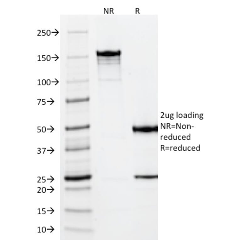 SDS-PAGE - Anti-Vimentin Antibody [VM452] (A250307) - Antibodies.com