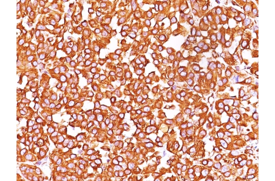 Immunohistochemistry - Anti-Vimentin Antibody [SPM576] (A250307) - Antibodies.com