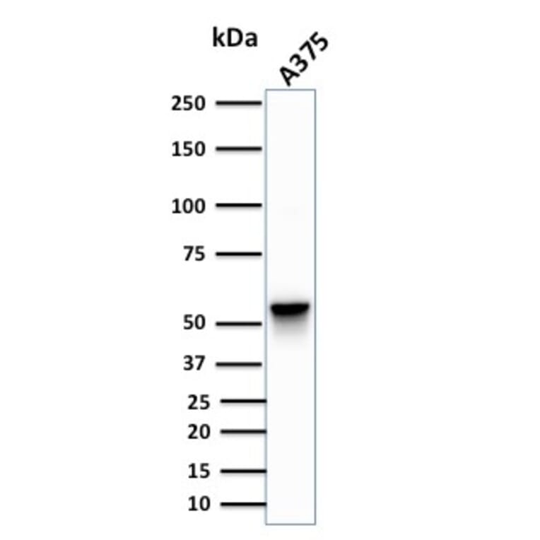 Western Blot - Anti-Vimentin Antibody [SPM576] (A250308) - Antibodies.com