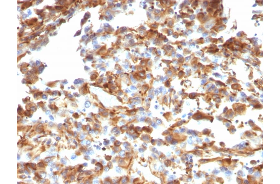 Immunohistochemistry - Anti-Vimentin Antibody [VM1170] (A250309) - Antibodies.com