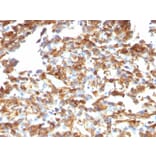 Immunohistochemistry - Anti-Vimentin Antibody [VM1170] (A250309) - Antibodies.com
