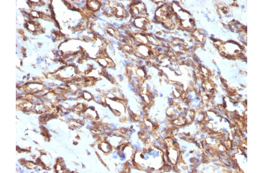 Immunohistochemistry - Anti-Vimentin Antibody [VM1170] (A250308) - Antibodies.com