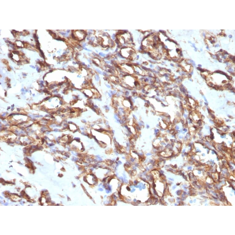 Immunohistochemistry - Anti-Vimentin Antibody [VM1170] (A250308) - Antibodies.com