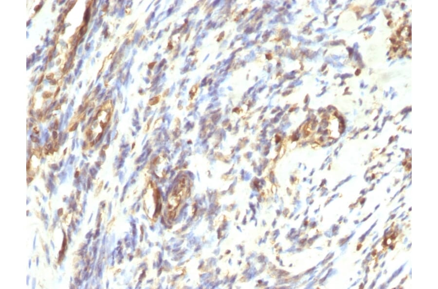 Immunohistochemistry - Anti-Vimentin Antibody [VM1170] (A250309) - Antibodies.com