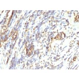 Immunohistochemistry - Anti-Vimentin Antibody [VM1170] (A250309) - Antibodies.com