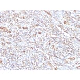 Immunohistochemistry - Anti-Vimentin Antibody [VM1170] (A250309) - Antibodies.com