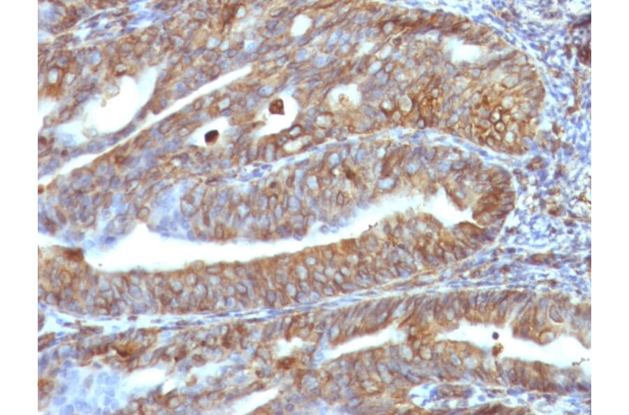 Immunohistochemistry - Anti-Vimentin Antibody [VM1170] (A250309) - Antibodies.com