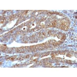Immunohistochemistry - Anti-Vimentin Antibody [VM1170] (A250309) - Antibodies.com