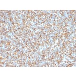 Immunohistochemistry - Anti-Vimentin Antibody [VM1170] (A250309) - Antibodies.com