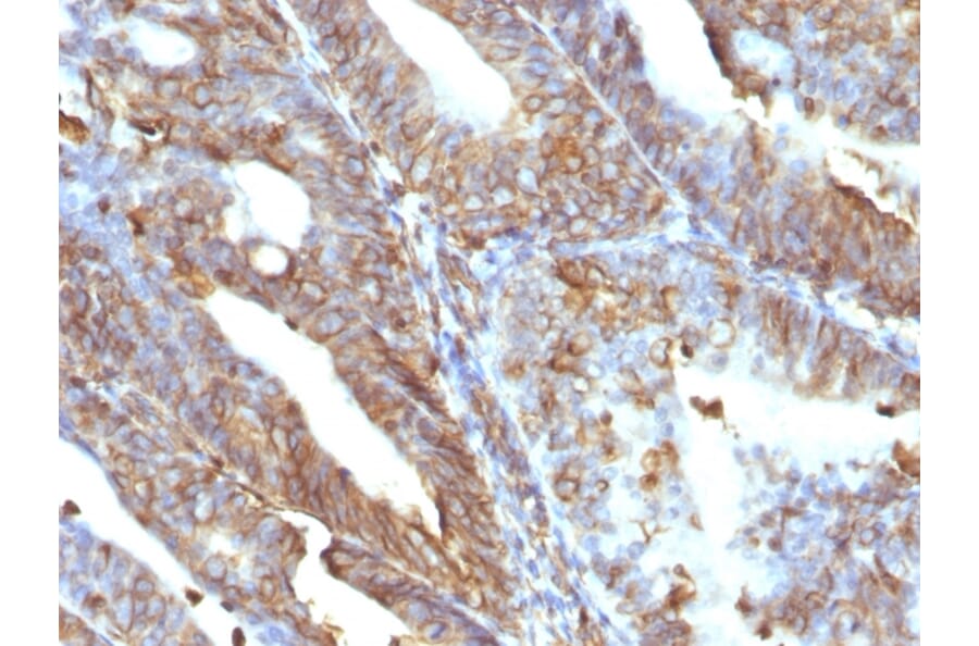 Immunohistochemistry - Anti-Vimentin Antibody [V9] (A250310) - Antibodies.com