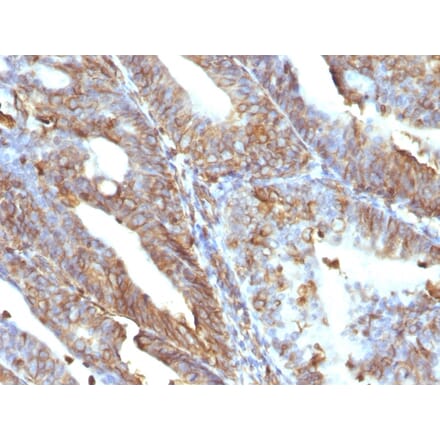 Immunohistochemistry - Anti-Vimentin Antibody [V9] (A250310) - Antibodies.com