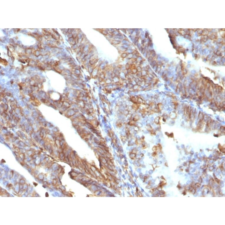 Immunohistochemistry - Anti-Vimentin Antibody [V9] (A250310) - Antibodies.com