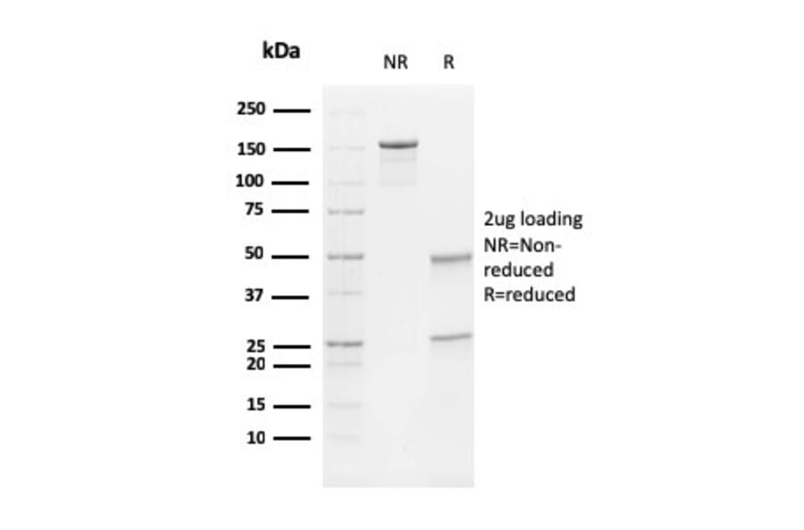 SDS-PAGE - Anti-Vimentin Antibody [V9] (A250310) - Antibodies.com