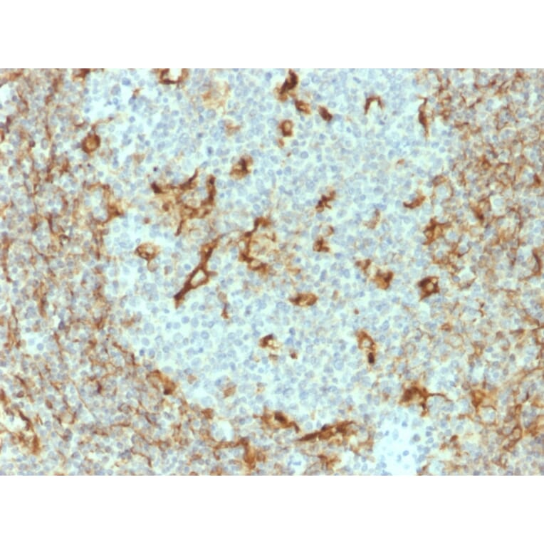 Immunohistochemistry - Anti-Vimentin Antibody [V9] (A250309) - Antibodies.com