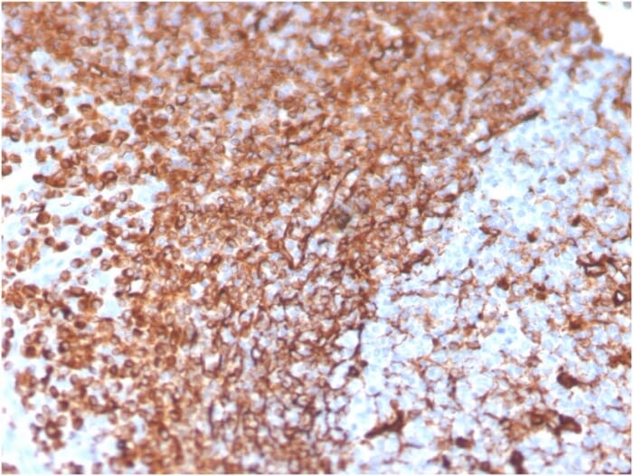 Immunohistochemical analysis of formalin-fixed, paraffin-embedded human tonsil using Anti-Vimentin Antibody [VIM/3736].