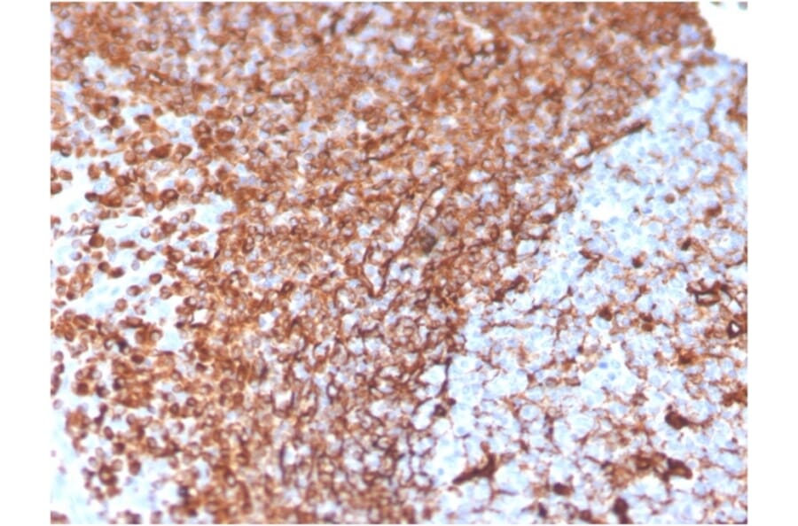 Immunohistochemistry - Anti-Vimentin Antibody [VIM/3736] (A250311) - Antibodies.com