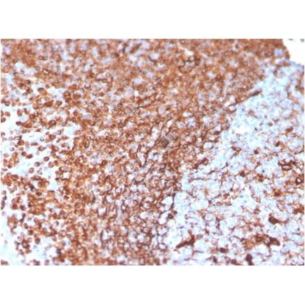Immunohistochemistry - Anti-Vimentin Antibody [VIM/3736] (A250311) - Antibodies.com