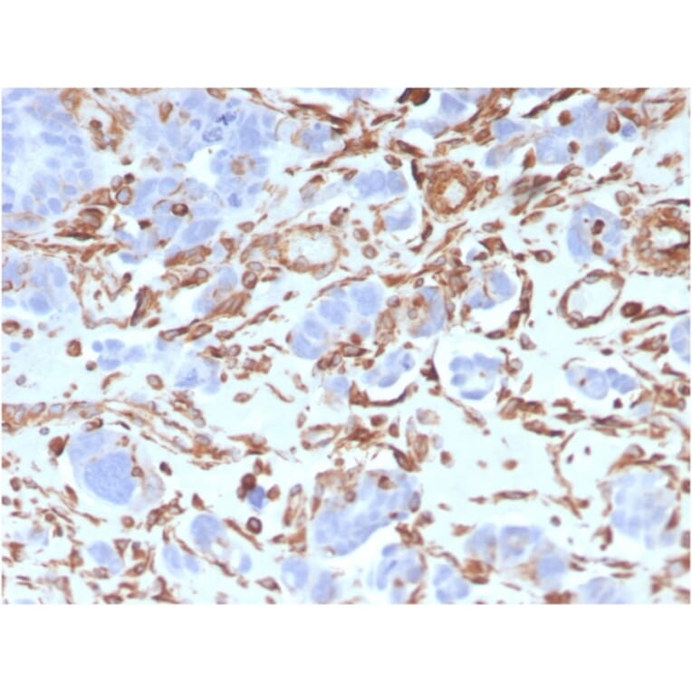 Immunohistochemistry - Anti-Vimentin Antibody [VIM/3736] (A250311) - Antibodies.com
