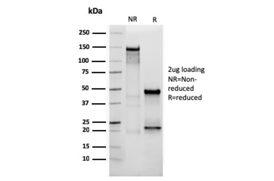 SDS-PAGE - Anti-Vimentin Antibody [VIM/3736] (A250311) - Antibodies.com