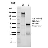 SDS-PAGE - Anti-Vimentin Antibody [VIM/3736] (A250311) - Antibodies.com
