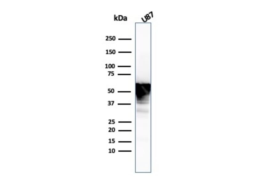 Western Blot - Anti-Vimentin Antibody [VIM/3736] (A250311) - Antibodies.com