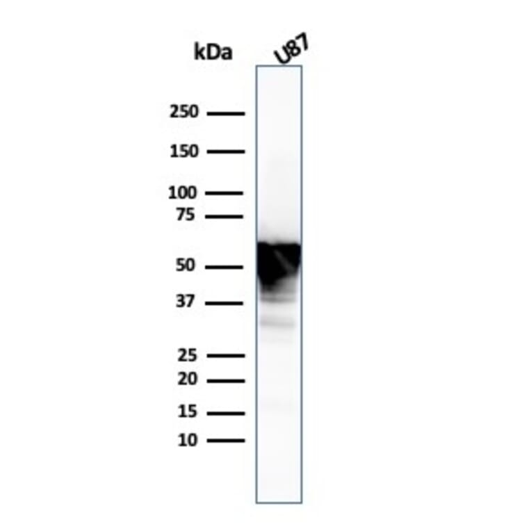 Western Blot - Anti-Vimentin Antibody [VIM/3736] (A250311) - Antibodies.com
