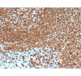 Immunohistochemistry - Anti-Vimentin Antibody [VIM/6430R] (A250312) - Antibodies.com