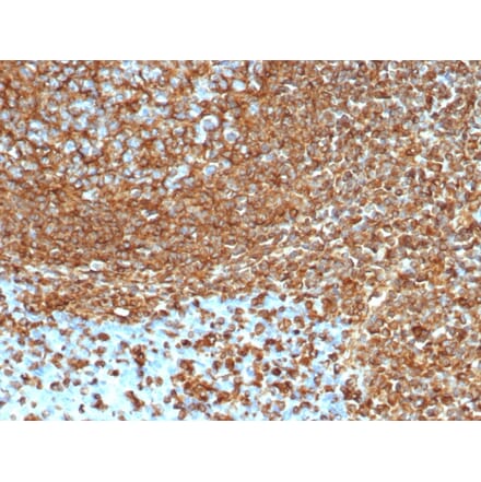Immunohistochemistry - Anti-Vimentin Antibody [VIM/6430R] (A250312) - Antibodies.com