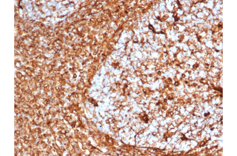 Immunohistochemistry - Anti-Vimentin Antibody [VIM/6576R] (A250313) - Antibodies.com