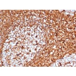 Immunohistochemistry - Anti-Vimentin Antibody [VIM/6576R] (A250312) - Antibodies.com