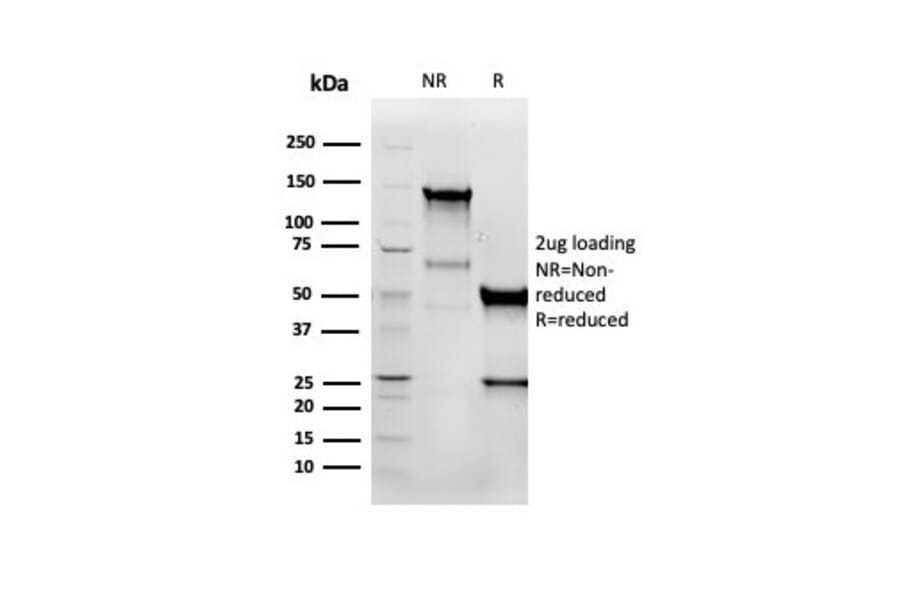 SDS-PAGE - Anti-Vimentin Antibody [VIM/6576R] (A250313) - Antibodies.com