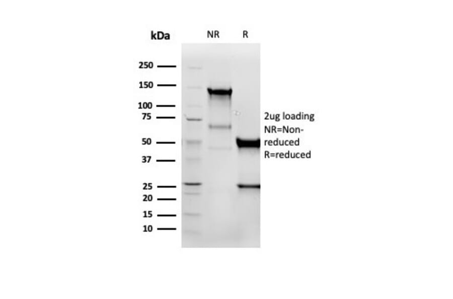Western Blot - Anti-Vimentin Antibody [VIM/6576R] (A250313) - Antibodies.com