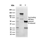 Western Blot - Anti-Vimentin Antibody [VIM/6576R] (A250313) - Antibodies.com