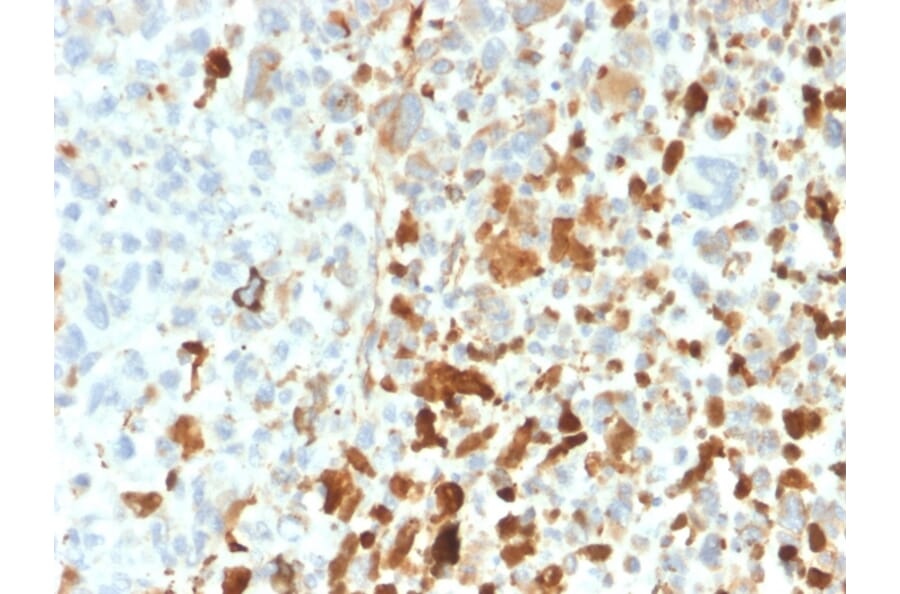 Immunohistochemistry - Anti-Vimentin Antibody [VIM/1937R] (A250314) - Antibodies.com